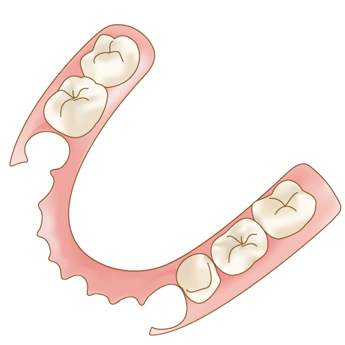 目立ちにくい入れ歯：「ノンクラスプデンチャー」